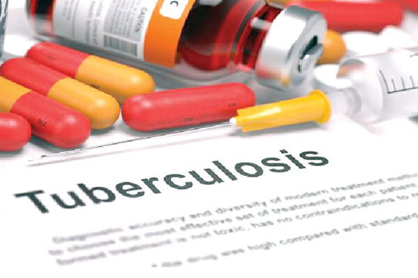 Childhood Tuberculosis Cases Rise in Europe, WHO Report Warns